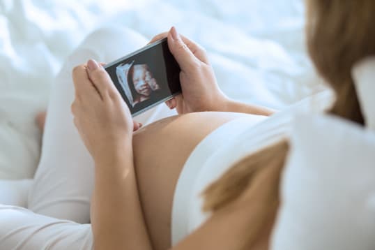 3D & 4D Ultrasounds