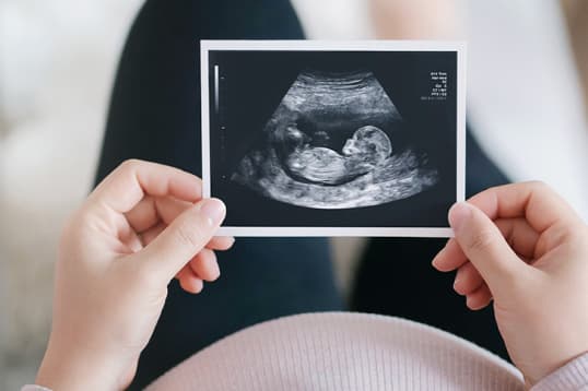Ultrasound